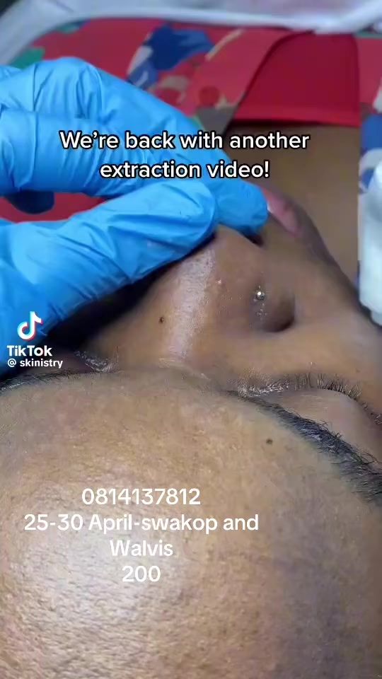 TikTok video thumbnail by gee99nangula1