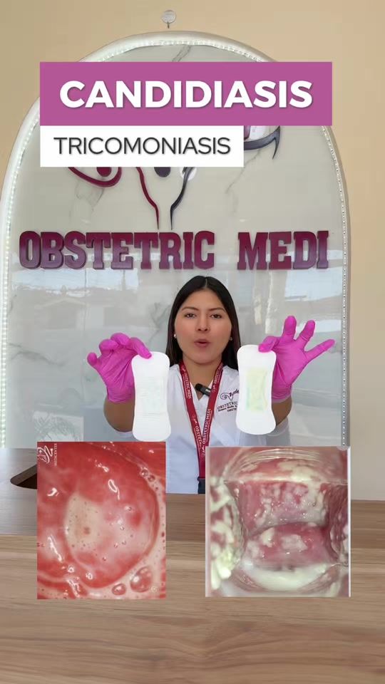 TikTok video thumbnail by obstetricmedi
