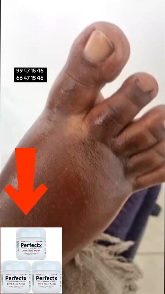 TikTok video thumbnail by bekoecommerce.gn1