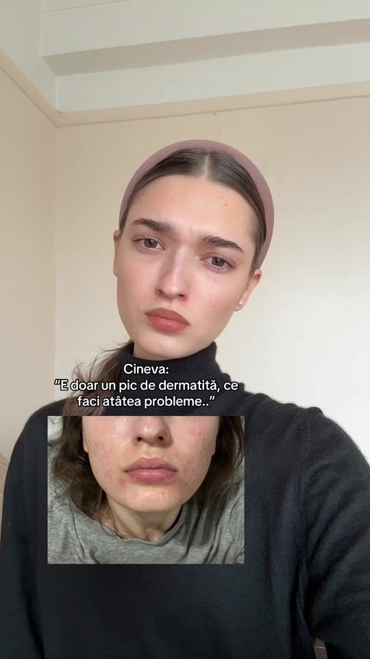 TikTok video thumbnail by alyy.nna