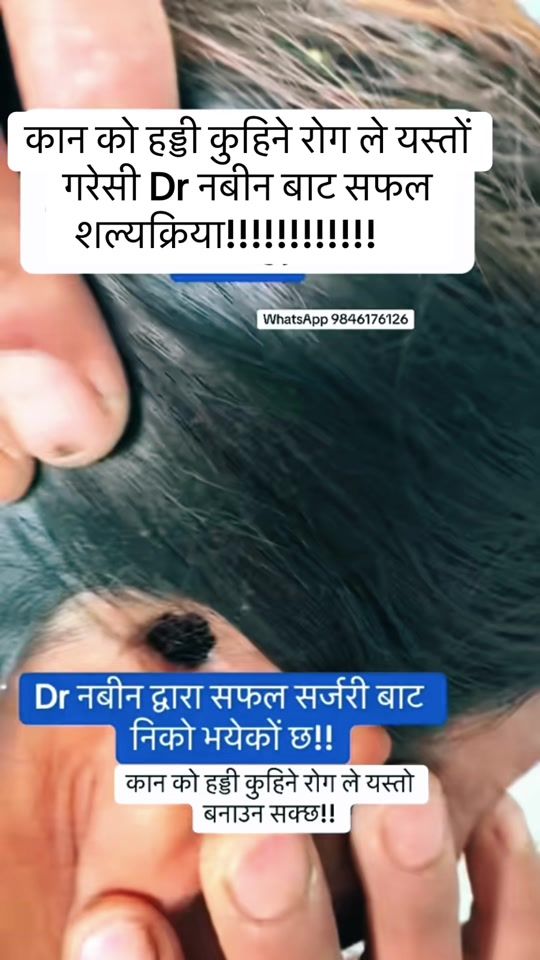 TikTok video thumbnail by dr.nabin123