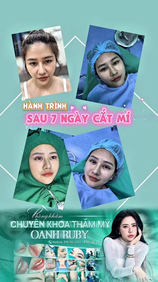 TikTok video thumbnail by hanglunie