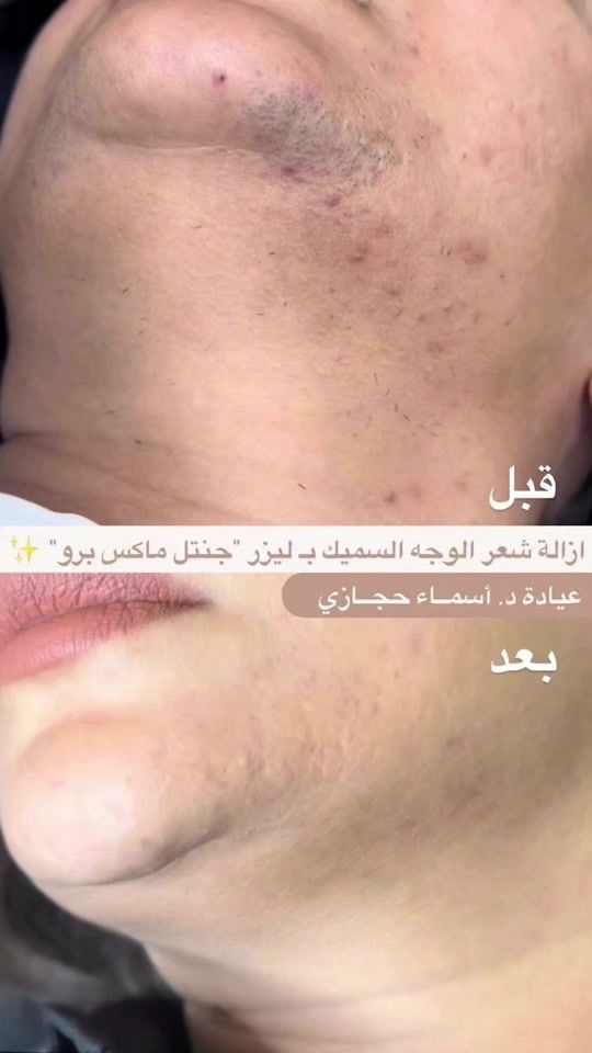 TikTok video thumbnail by asmaahigazy2004