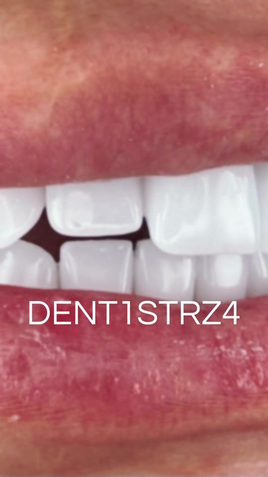TikTok video thumbnail by dentistrza