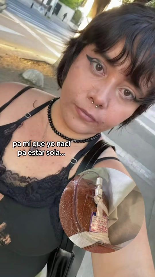 TikTok video thumbnail by fervillaloboos