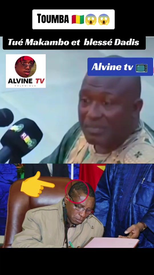 TikTok video thumbnail by alvine.polmique.t