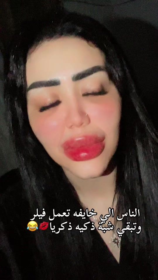 TikTok video thumbnail by ronyali33