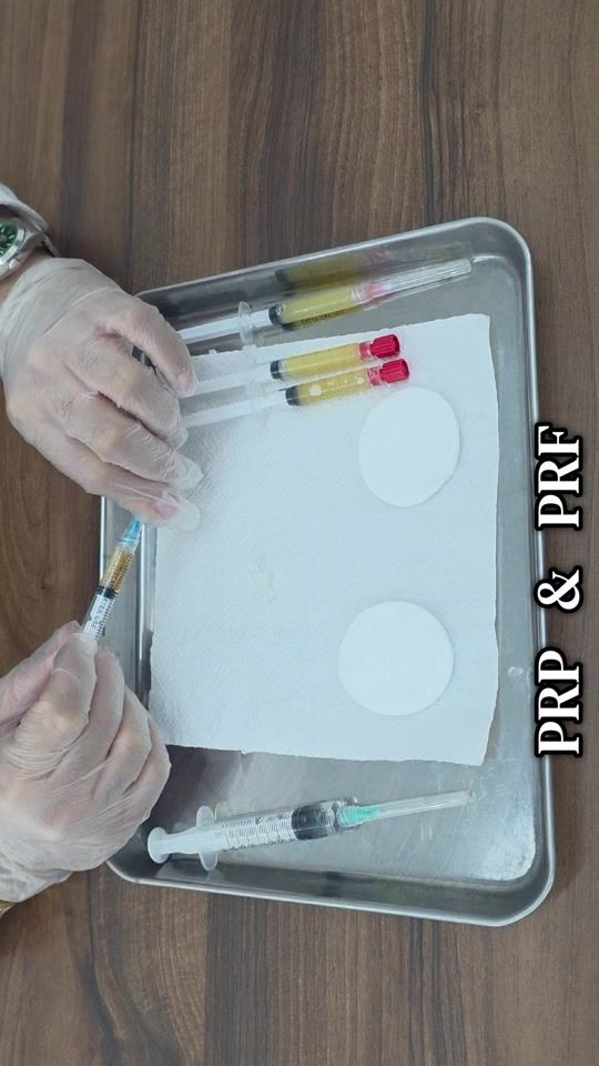 TikTok video thumbnail by pierreach