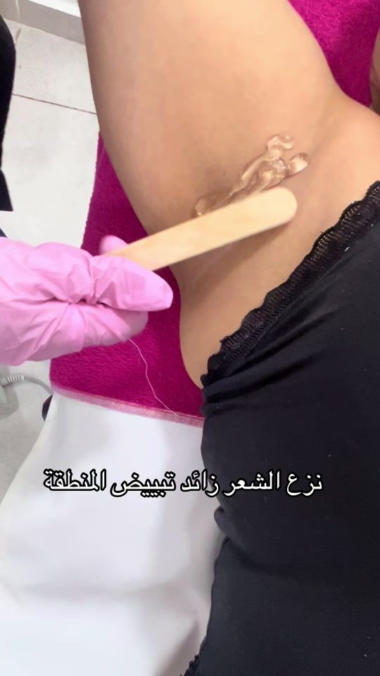 TikTok video thumbnail by dr.chaallel