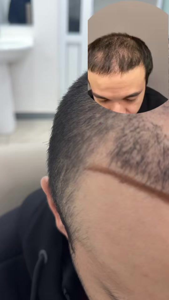TikTok video thumbnail by dr_narzullayevich_