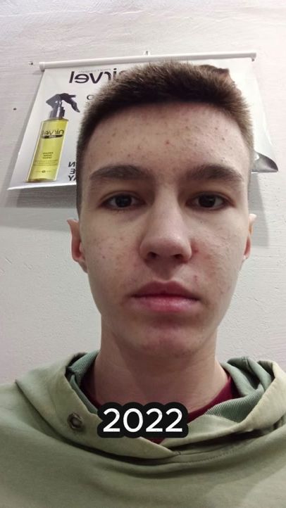 TikTok video thumbnail by th0rik