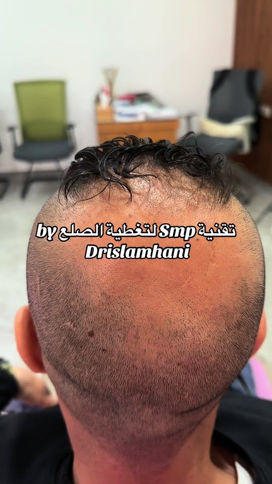 TikTok video thumbnail by dr.islamhani