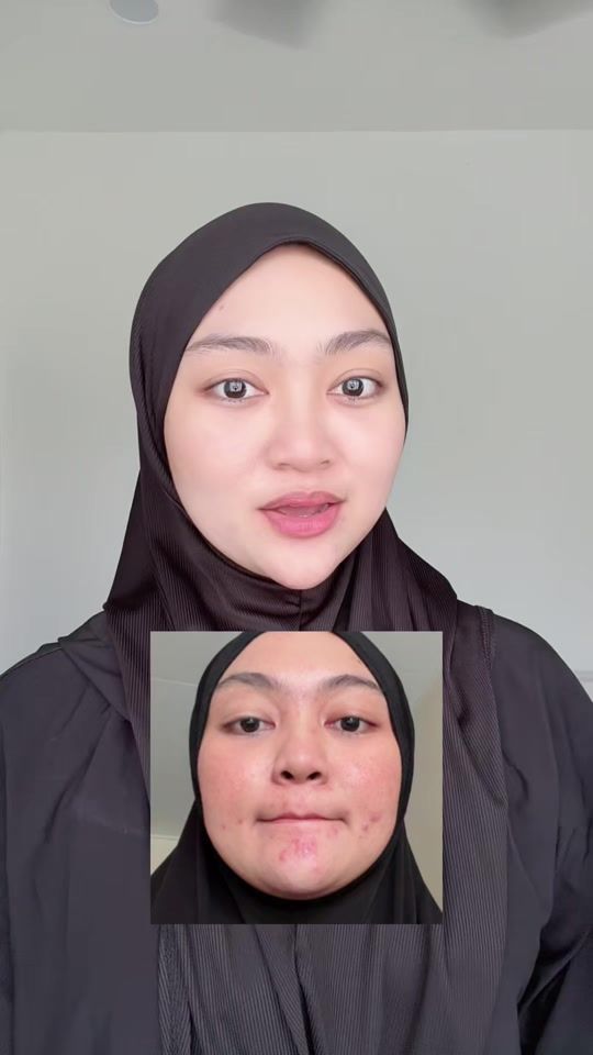 TikTok video thumbnail by ayudyu