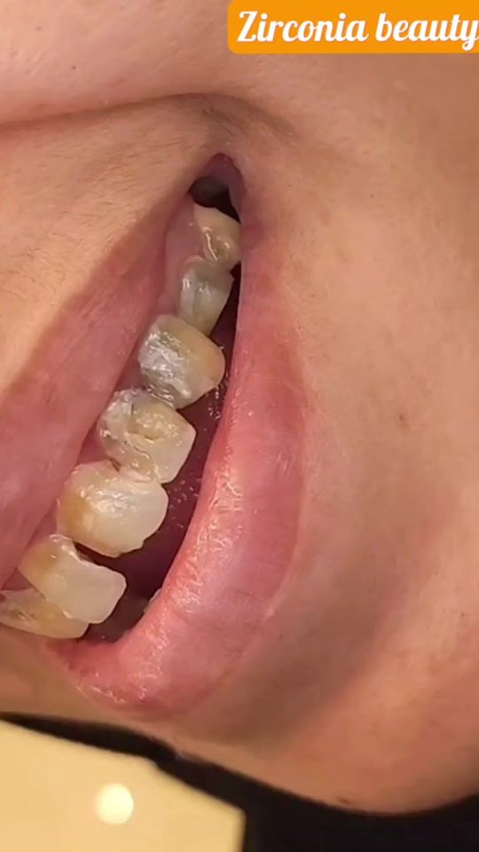 TikTok video thumbnail by dr_shakeel_s_a