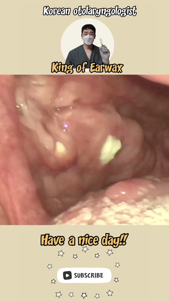TikTok video thumbnail by king_of_earwax