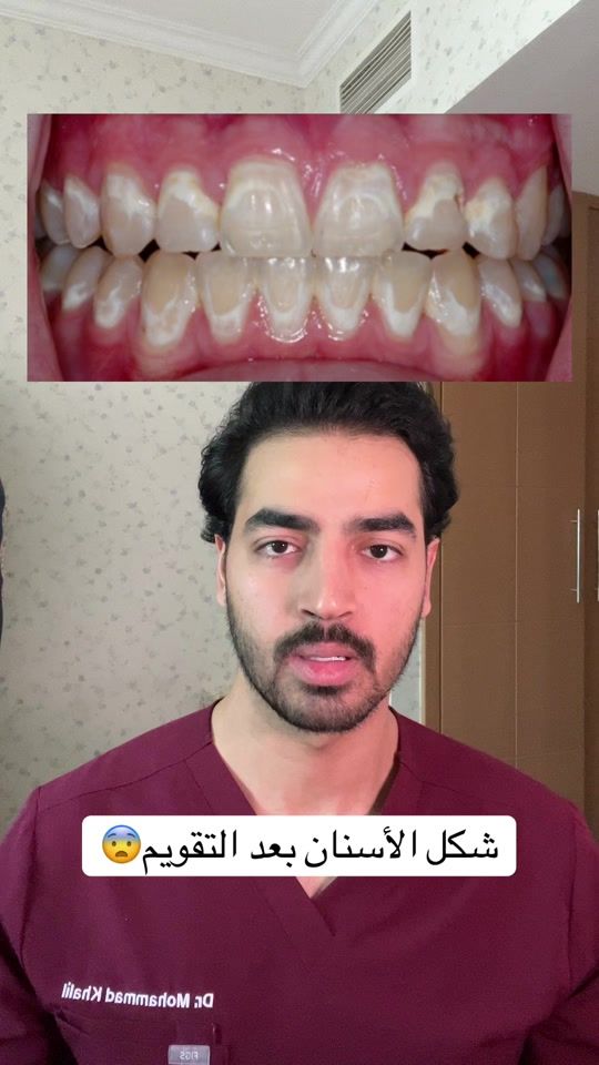 TikTok video thumbnail by dr.mohammad_khaalil