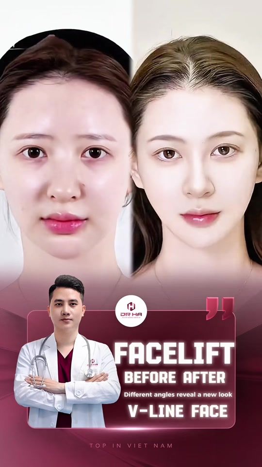 TikTok video thumbnail by dr.ha856