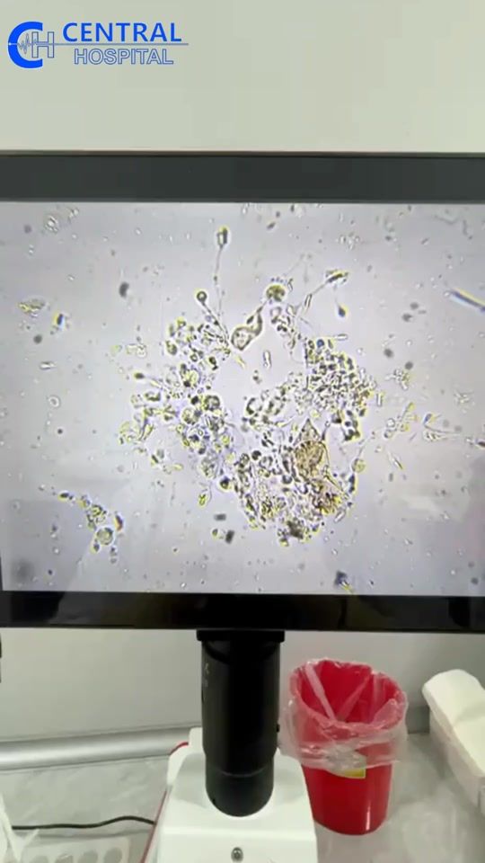 TikTok video thumbnail by central_hospital_eyyublu