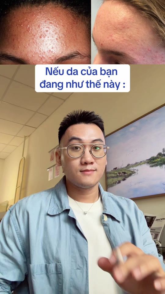 TikTok video thumbnail by drquangho