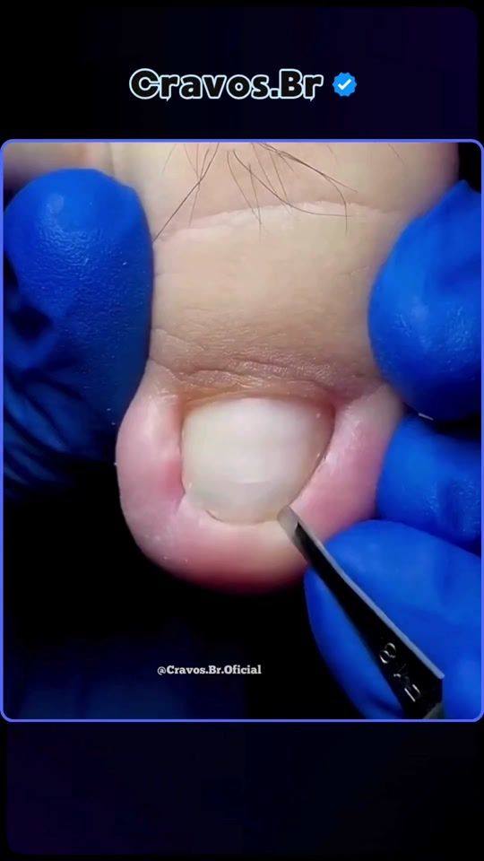 TikTok video thumbnail by cravos.br.oficial