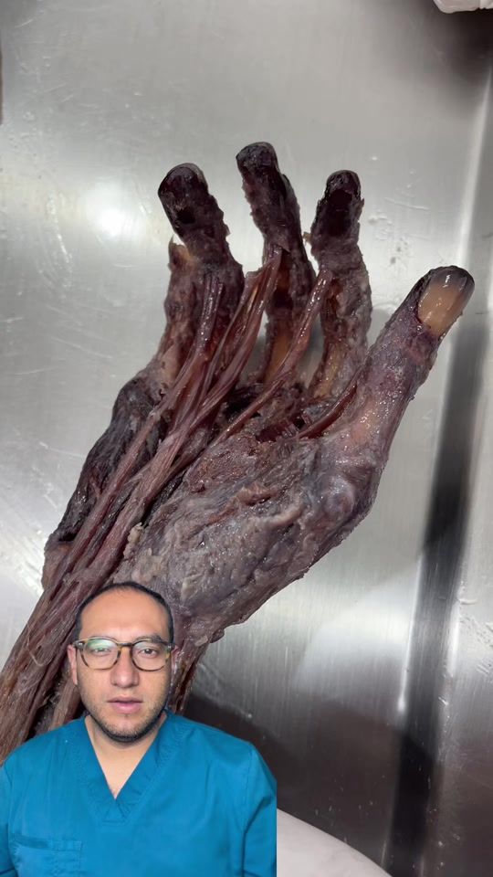 TikTok video thumbnail by dr.giogalindo
