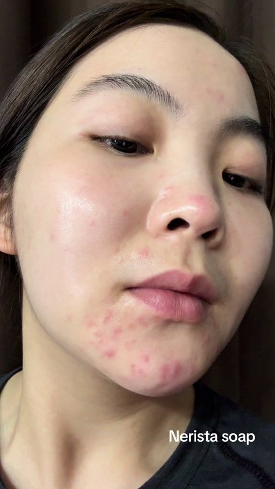 TikTok video thumbnail by rotsarinn