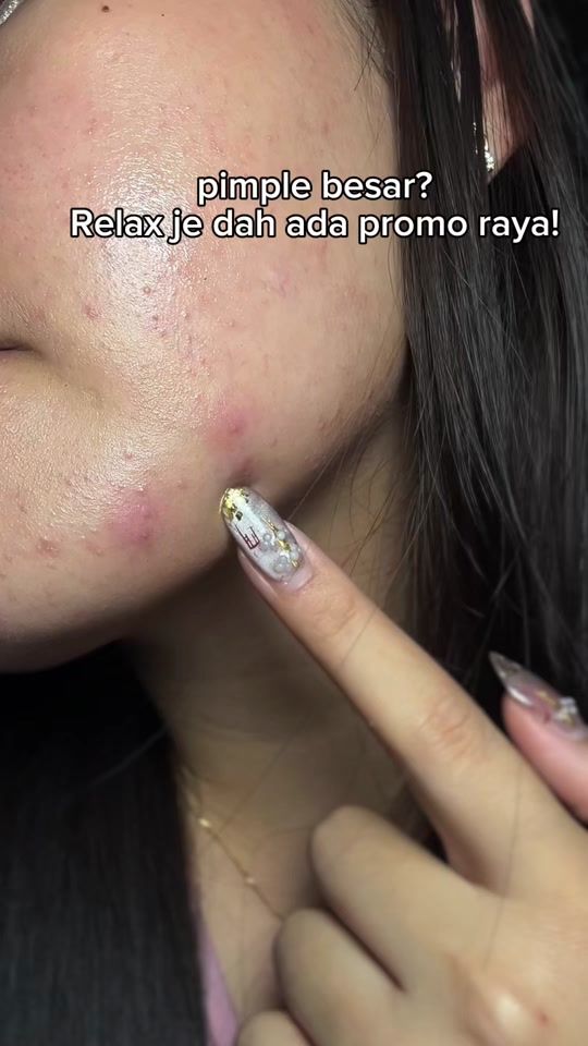 TikTok video thumbnail by aksj._