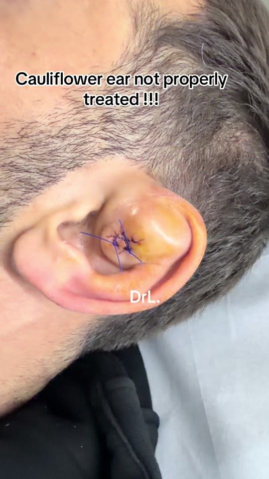 TikTok video thumbnail by drlindahamouche