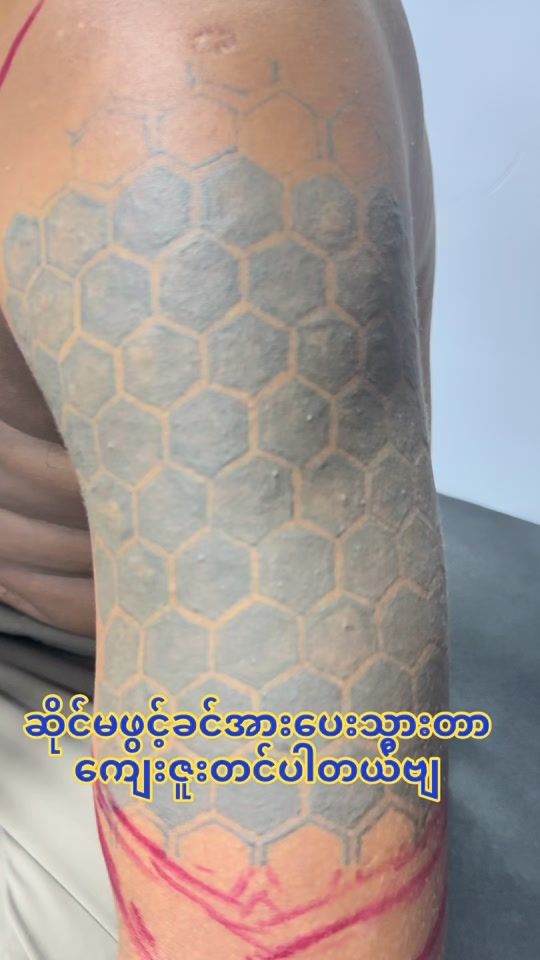 TikTok video thumbnail by zawwinmg005