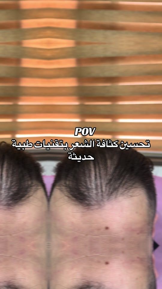 TikTok video thumbnail by dr.islamhani