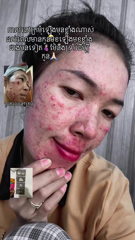 TikTok video thumbnail by dyqmhxr6uuc3