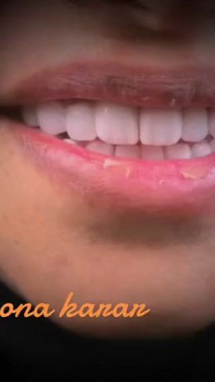 TikTok video thumbnail by dr.monnaa