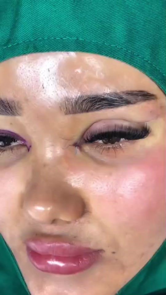 TikTok video thumbnail by uzman.doktorlar