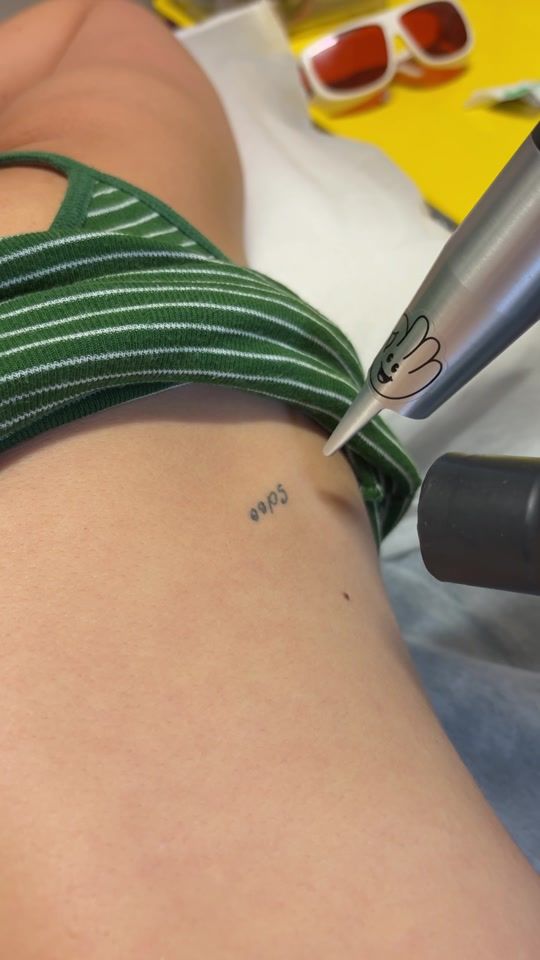 TikTok video thumbnail by swift_tattoo_removal
