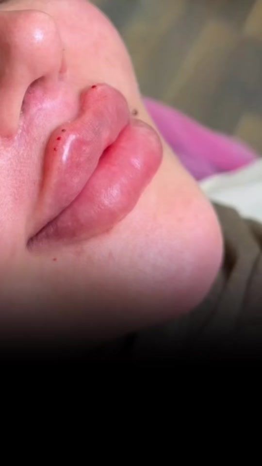 TikTok video thumbnail by karada.clinic