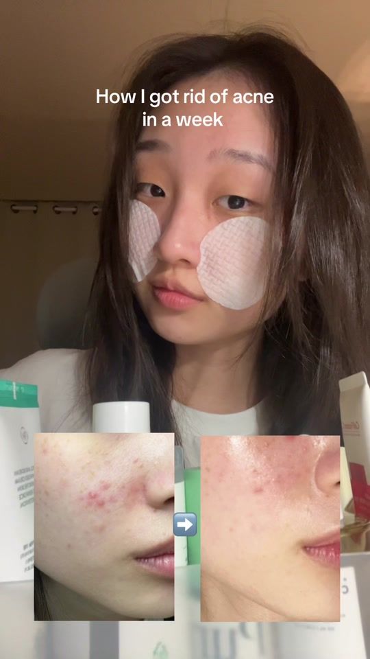 TikTok video thumbnail by yunas.sprout