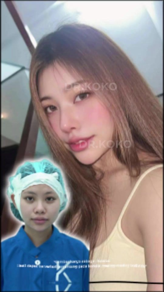 TikTok video thumbnail by dr.kokomd