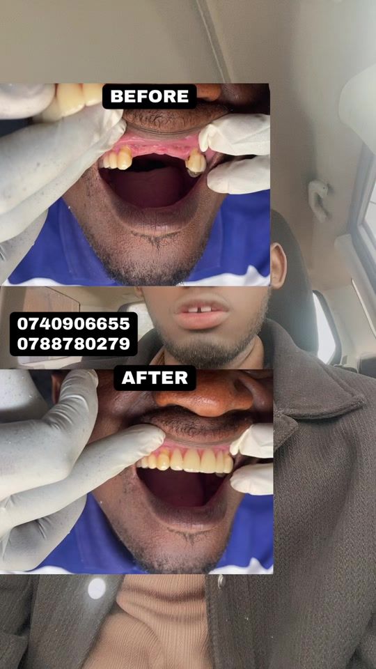 TikTok video thumbnail by dentalsolutionstv