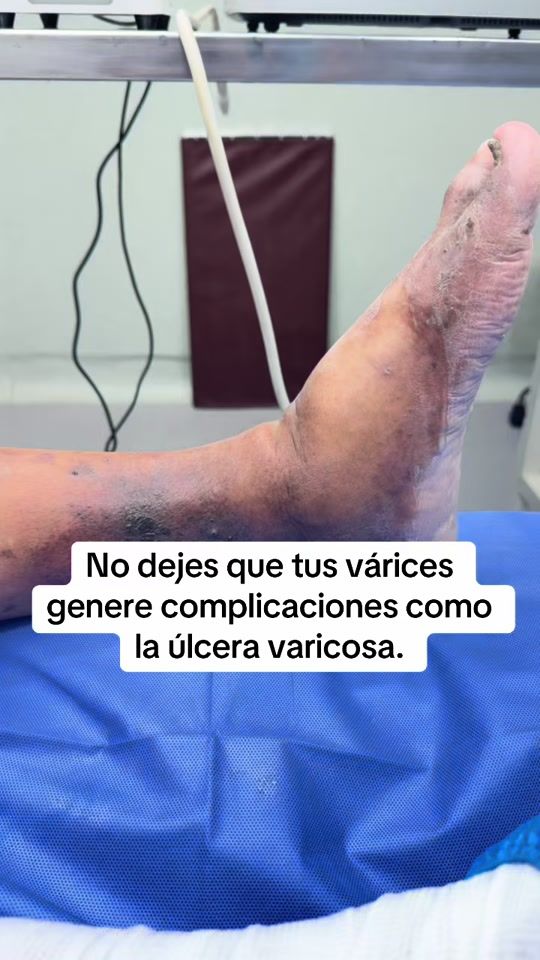 TikTok video thumbnail by dr.danteramosd