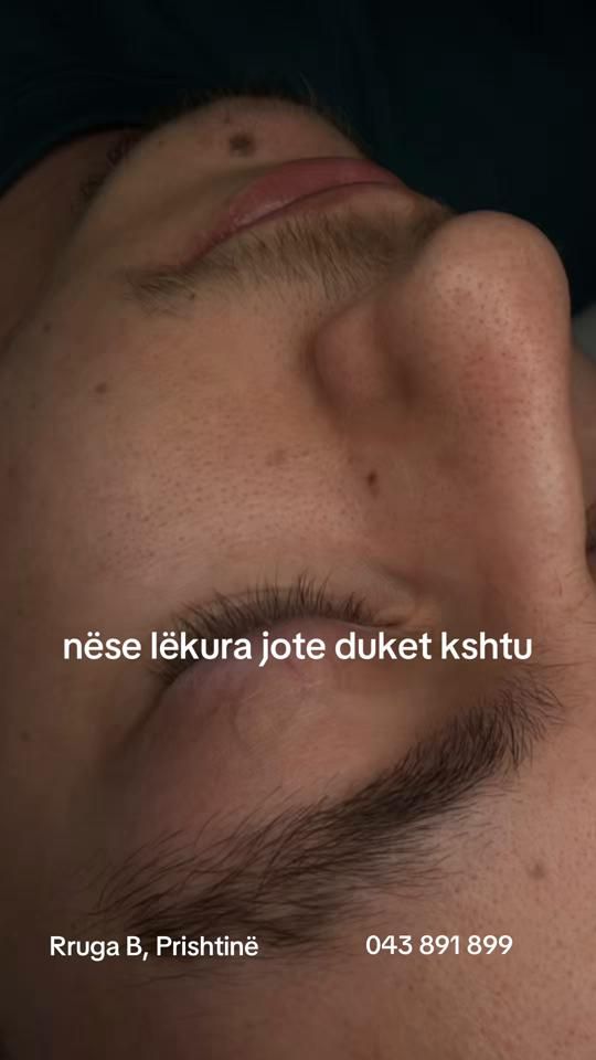 TikTok video thumbnail by anitabajrami_