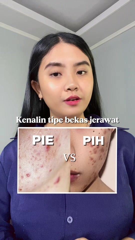 TikTok video thumbnail by glovsta