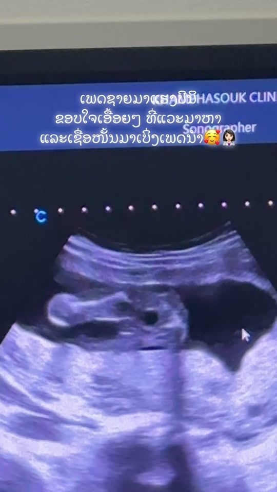 TikTok video thumbnail by soutthida277