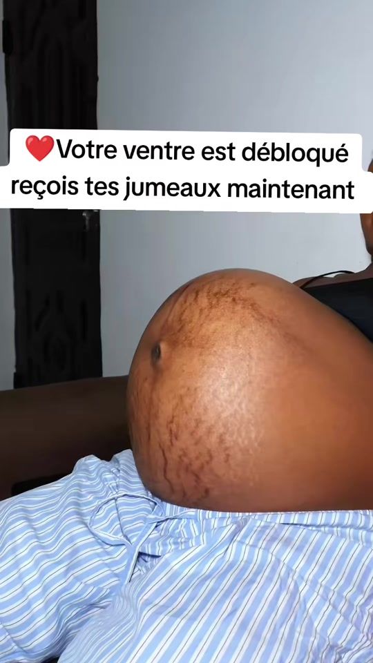 TikTok video thumbnail by mdecine.tradition1