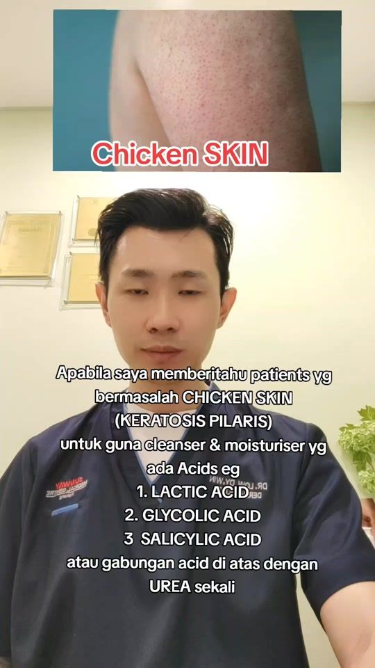 TikTok video thumbnail by askdr.low.dywin