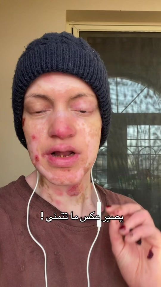 TikTok video thumbnail by abrar.alothman