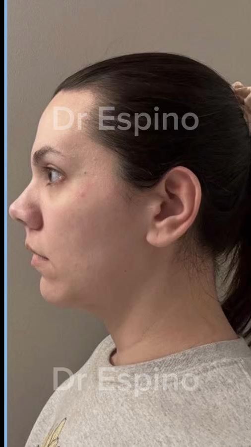 TikTok video thumbnail by dr_espino