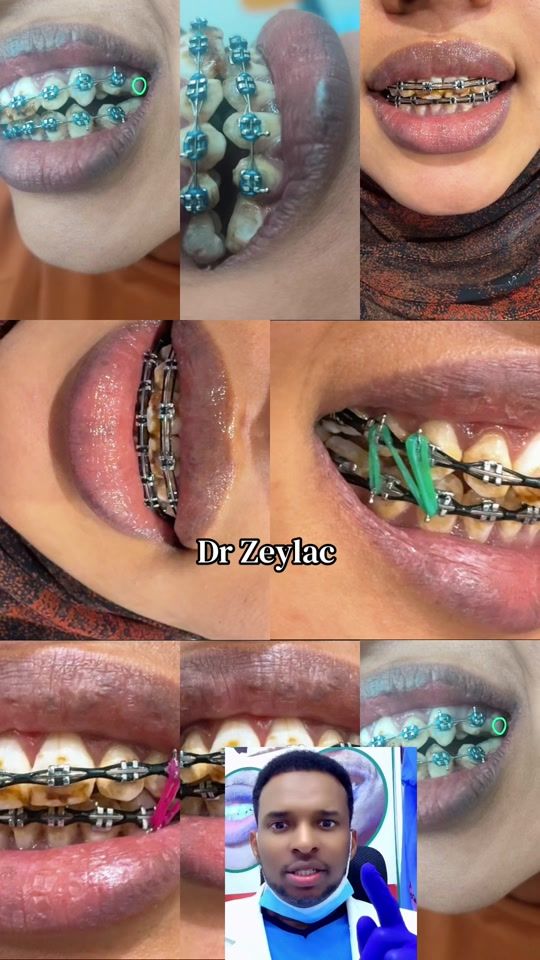 TikTok video thumbnail by dr_zeylac_1