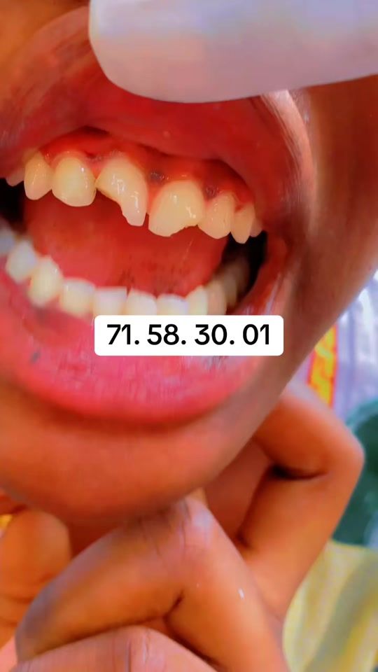TikTok video thumbnail by roikaou.09