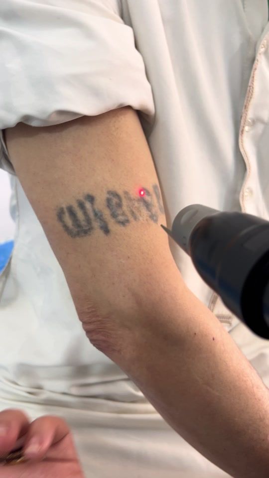 TikTok video thumbnail by dr.chaallel