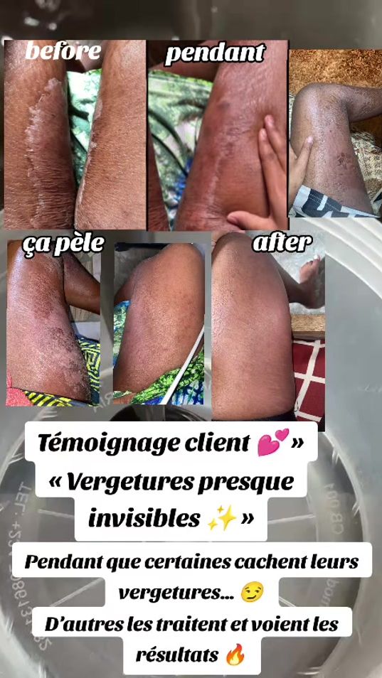 TikTok video thumbnail by vergertures